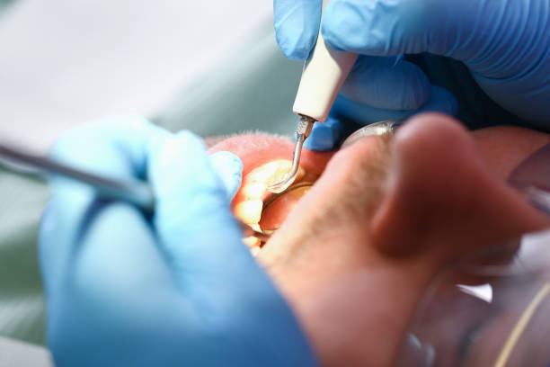 Best Root Canal Emergency Dentist  in Vauxhall, NJ